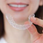 インビザラインフルとGO